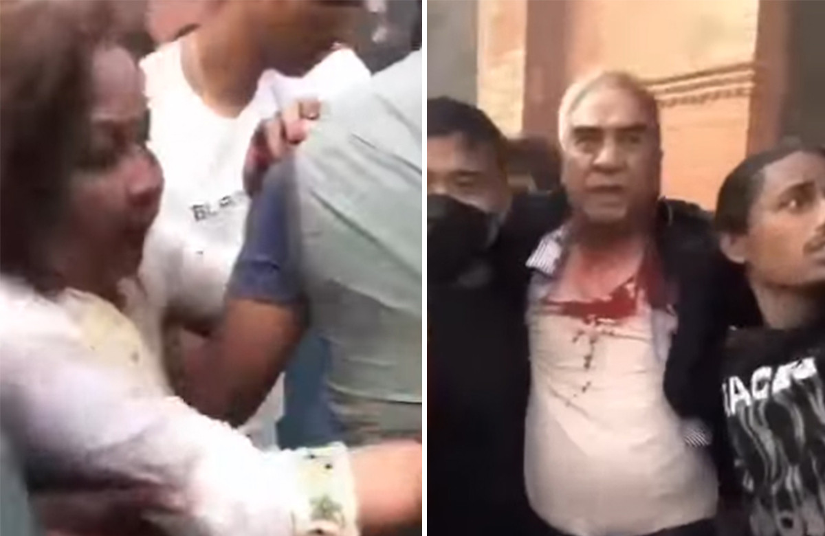 देउवा दम्पत्तीमाथि निवासमै पुगेर आक्रमण